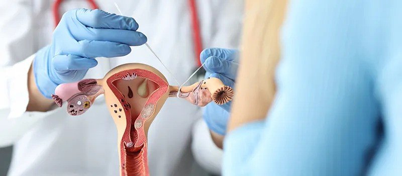 Gynecological checkup
